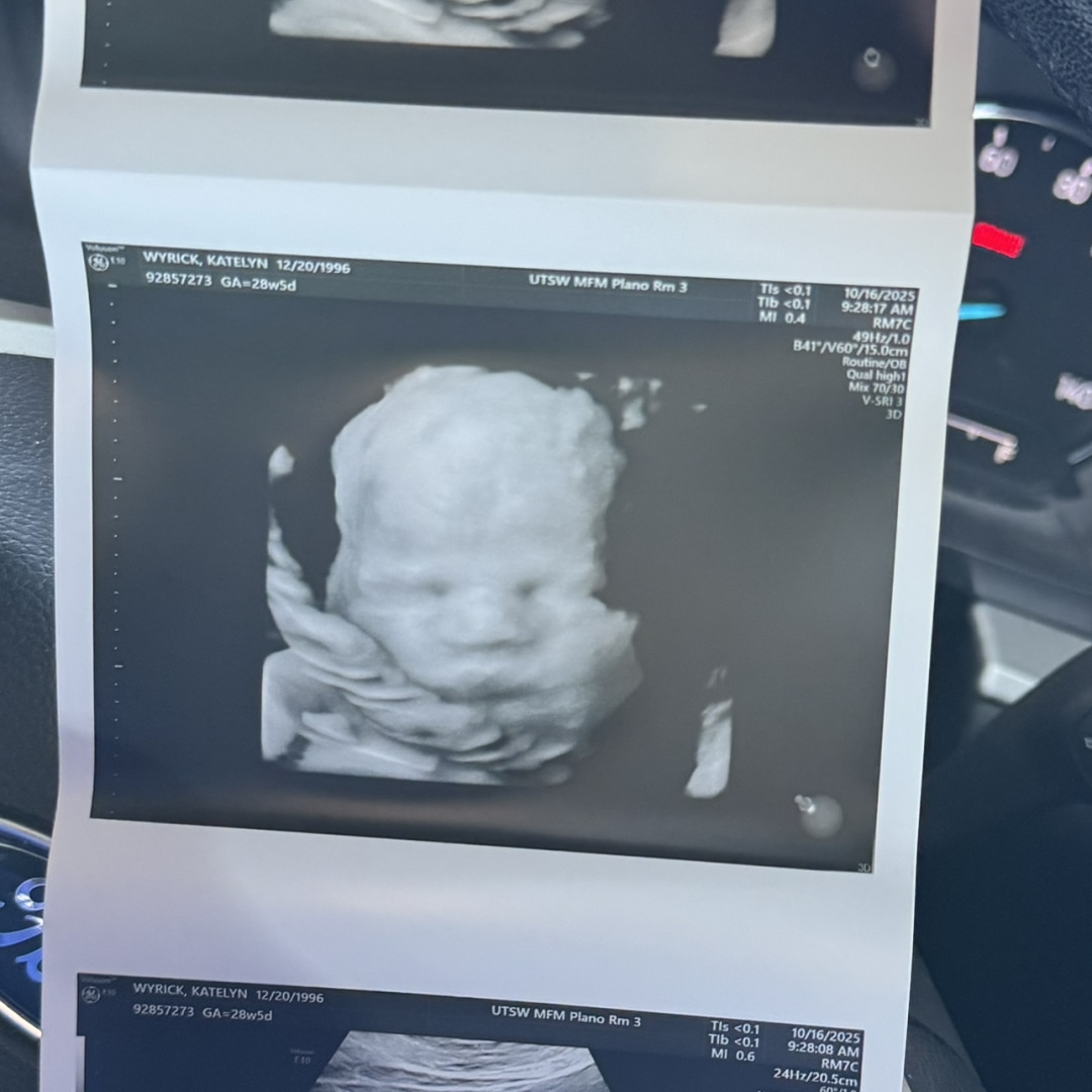 Photo shared by Katie for their Babylist baby registry.