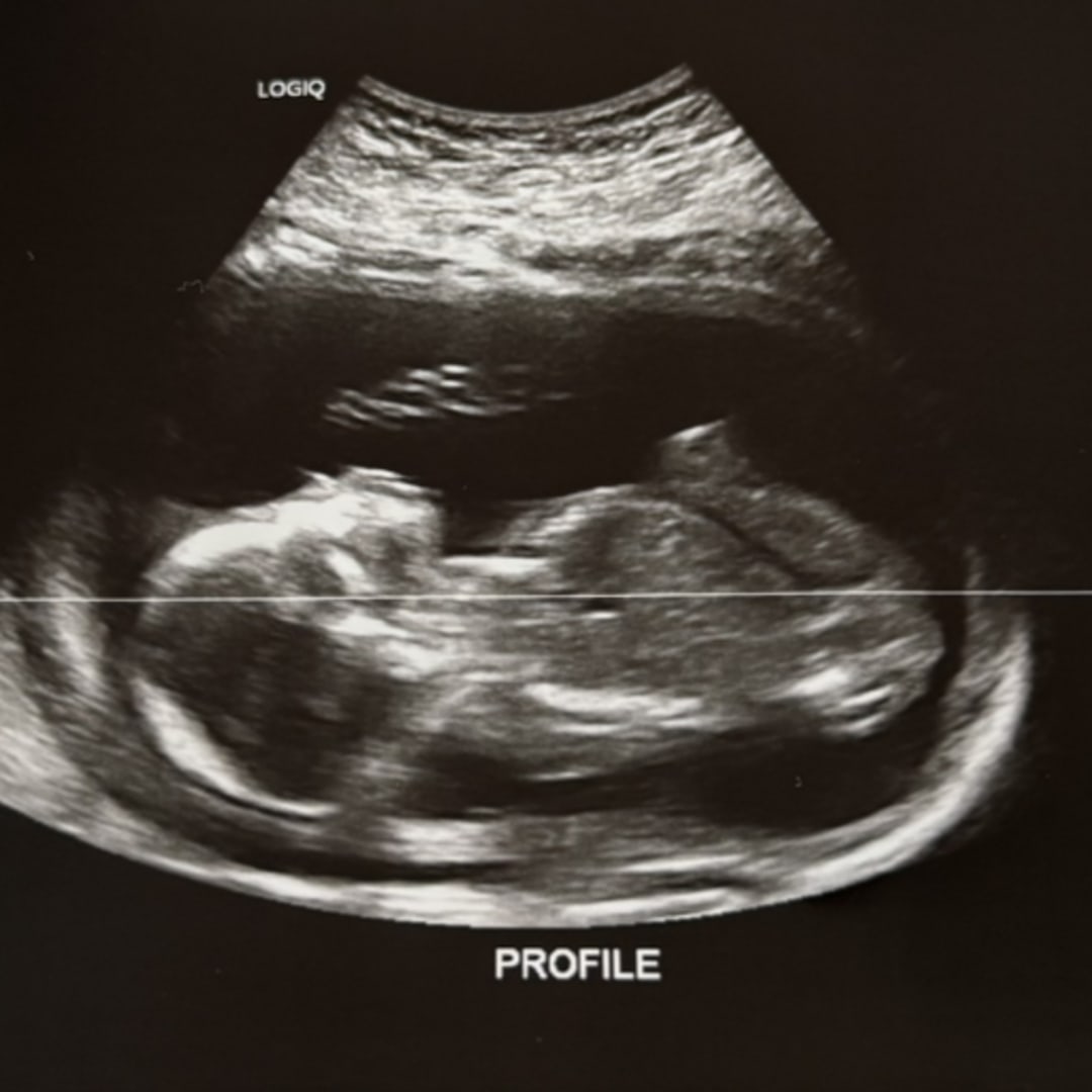 Photo shared by Fantasia for their Babylist baby registry.