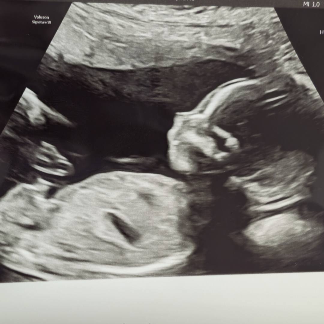 Photo shared by Feliza for their Babylist baby registry.