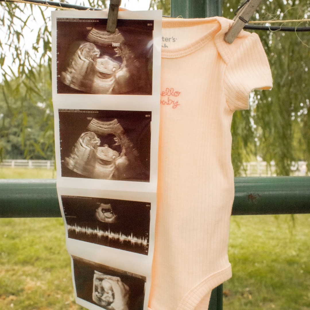 Photo shared by Sarah for their Babylist baby registry.