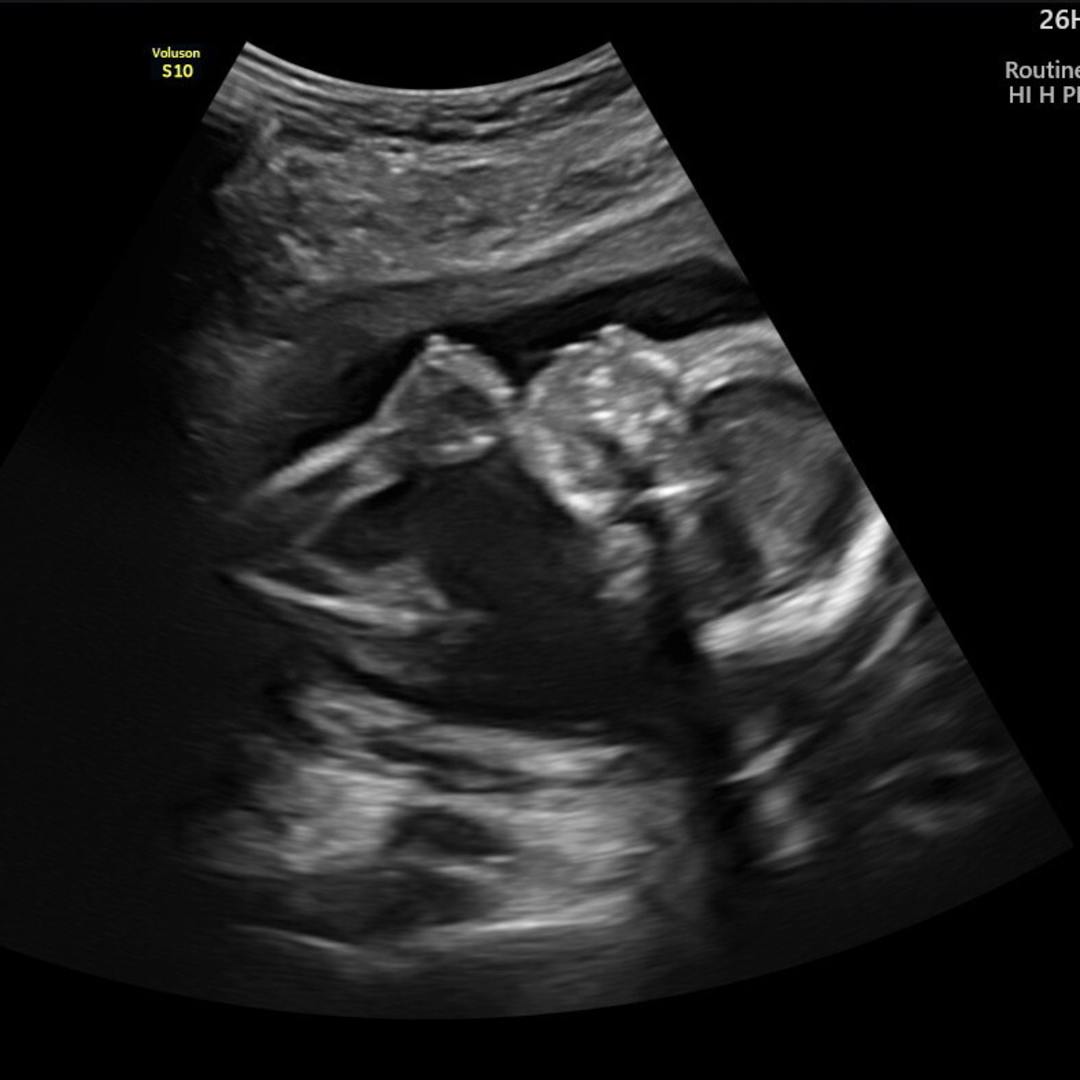 Photo shared by Dani for their Babylist baby registry.