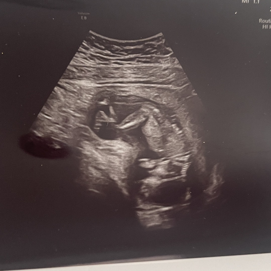Photo shared by Kelsie for their Babylist baby registry.