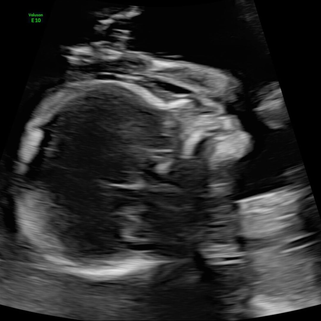 Photo shared by Meg for their Babylist baby registry.