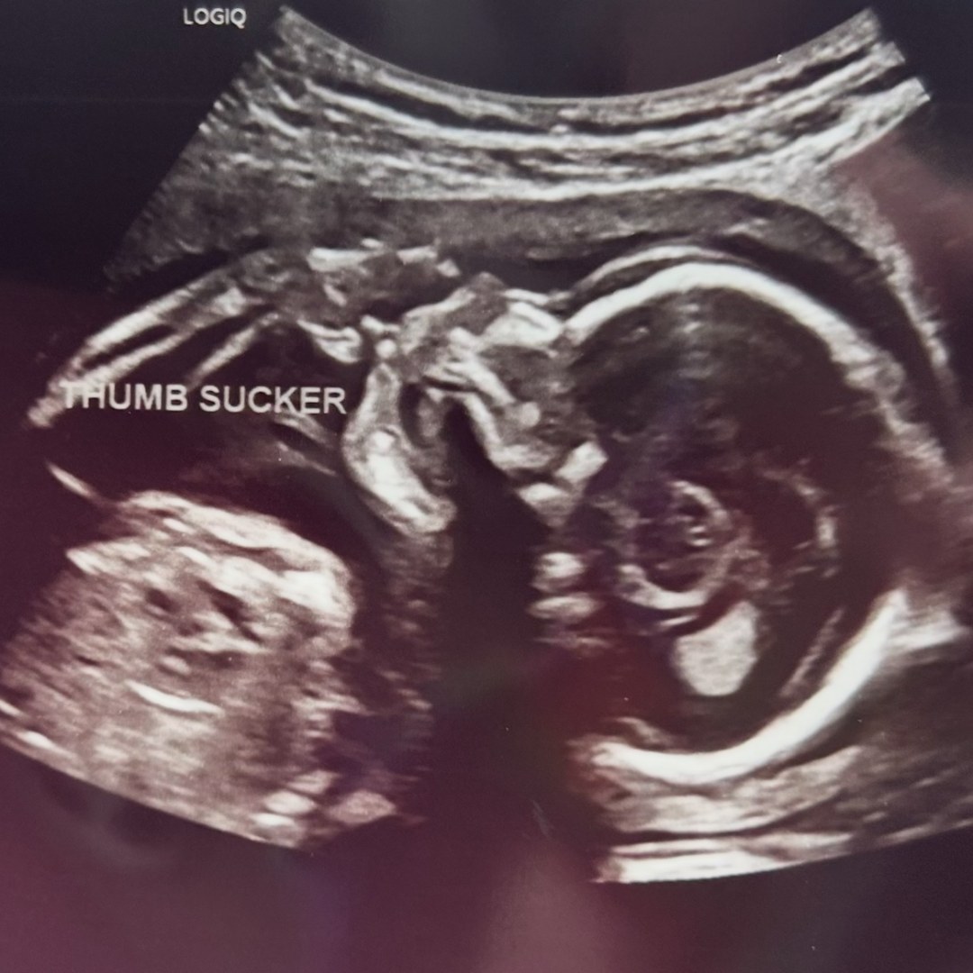 Photo shared by Brooke for their Babylist baby registry.