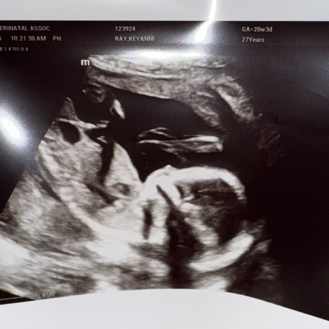 Photo shared by Keyanni for their Babylist baby registry.