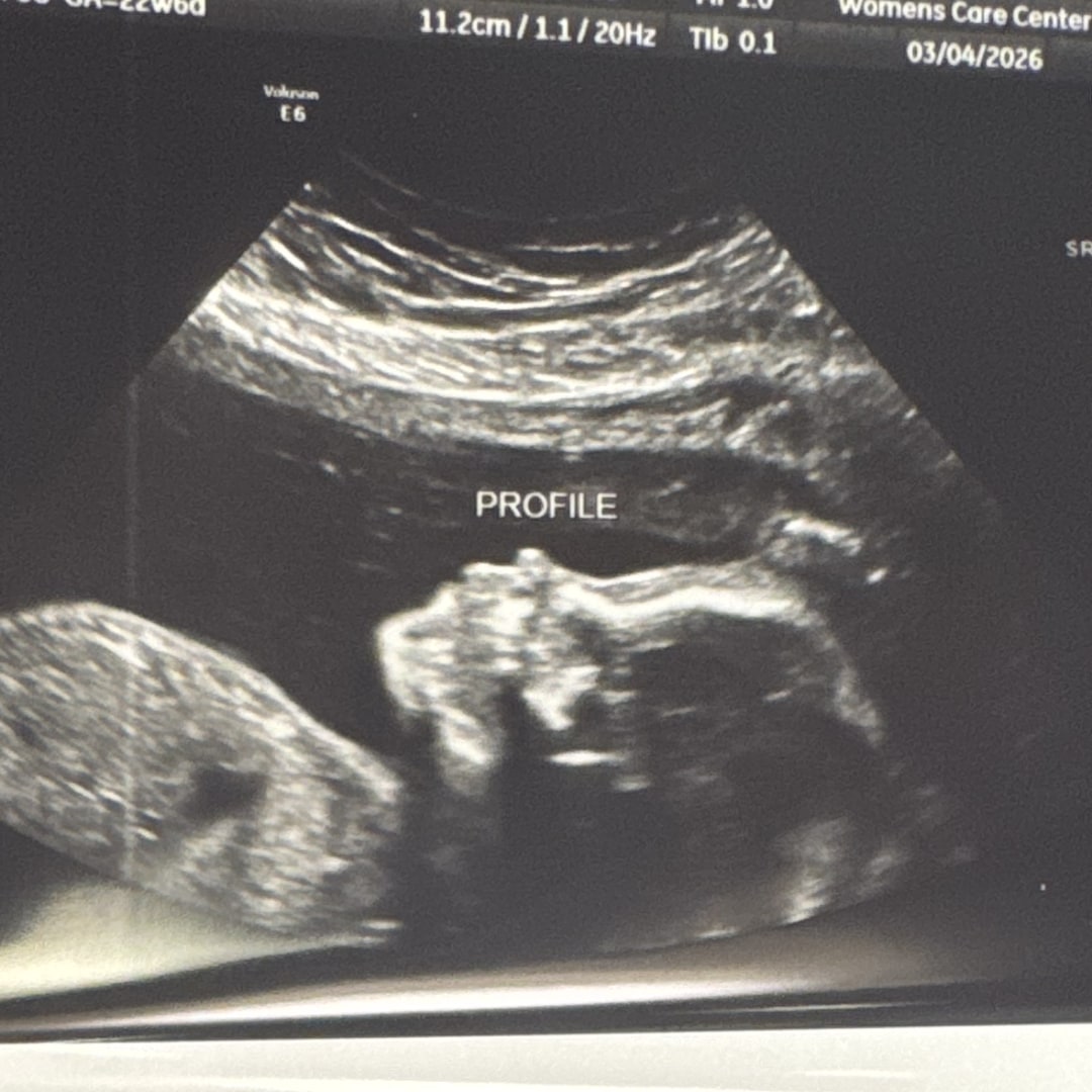 Photo shared by Katie for their Babylist baby registry.