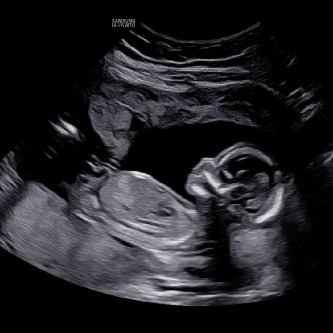 Photo shared by Ciera for their Babylist baby registry.