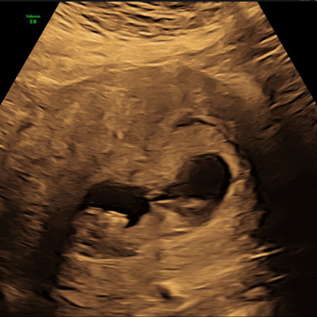 Photo shared by Alexa for their Babylist baby registry.