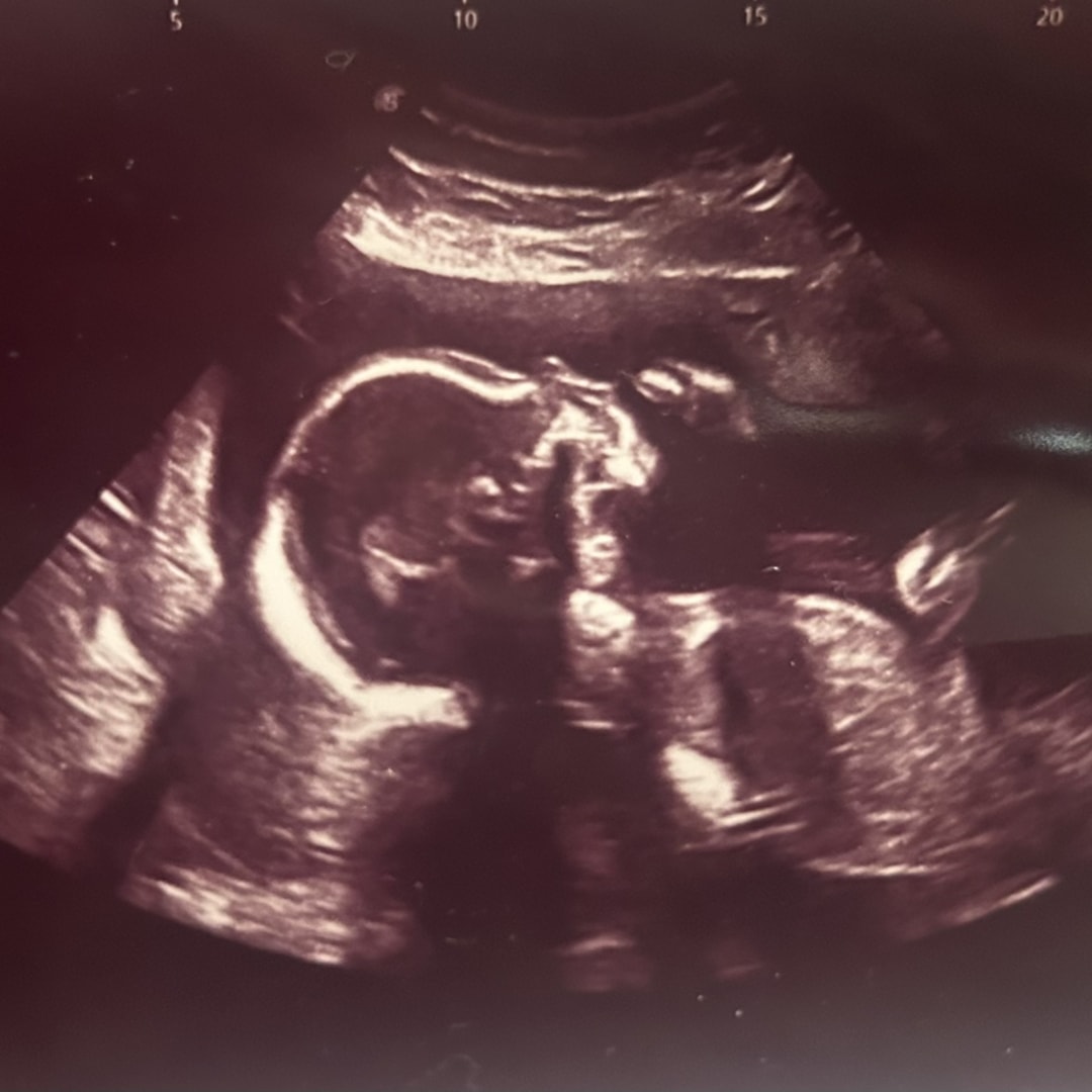 Photo shared by Maddi for their Babylist baby registry.