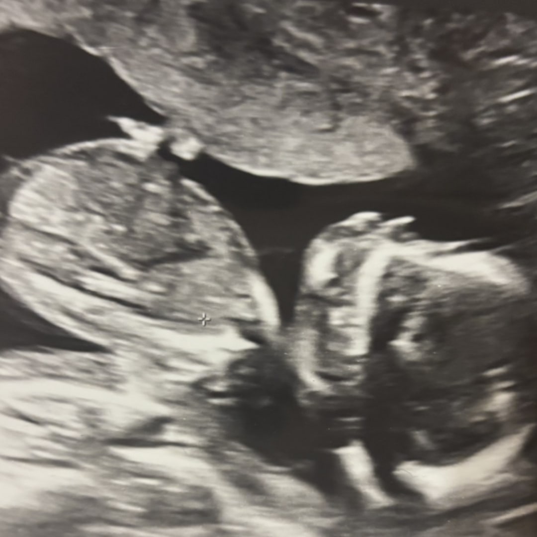 Photo shared by Chasity for their Babylist baby registry.