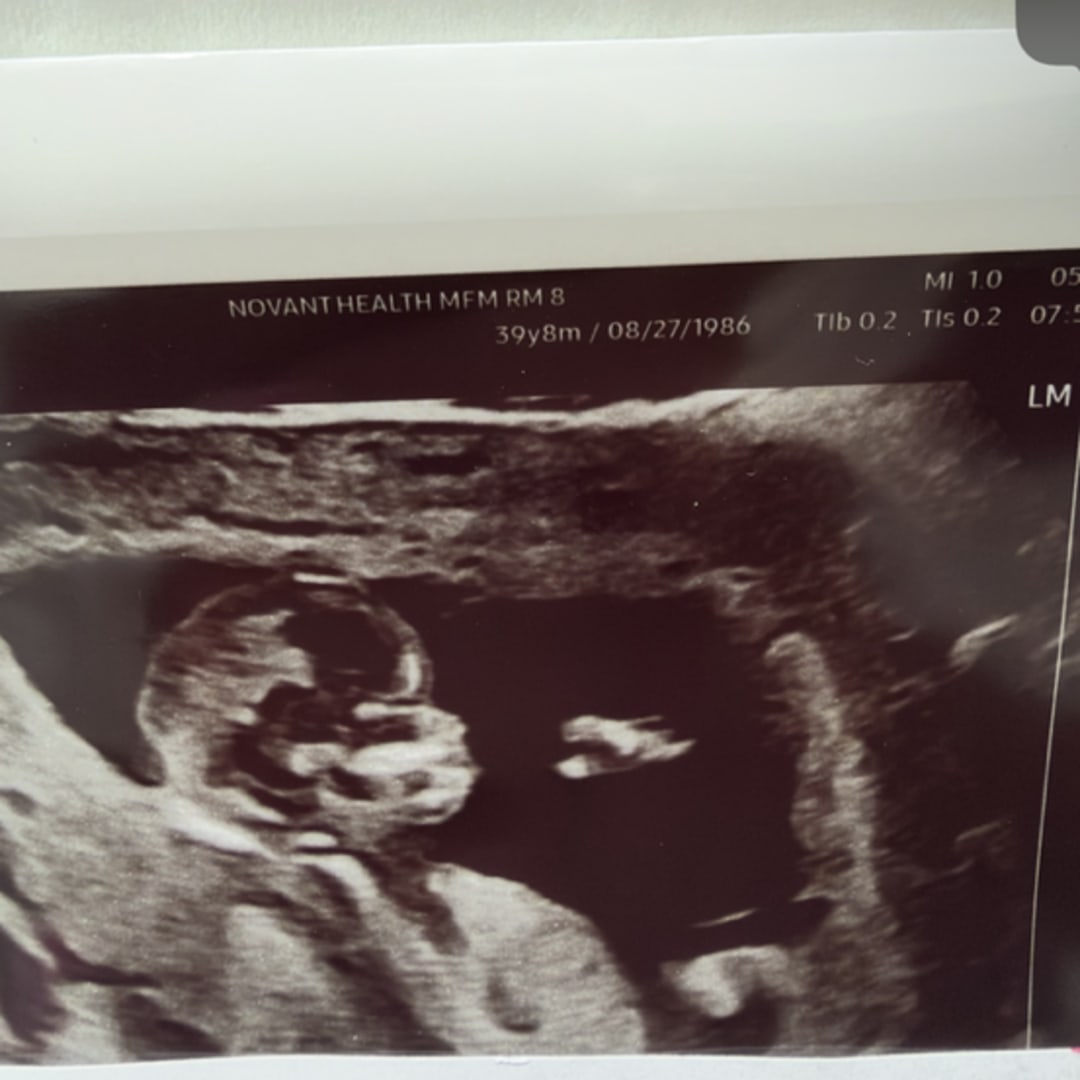 Photo shared by Erin for their Babylist baby registry.
