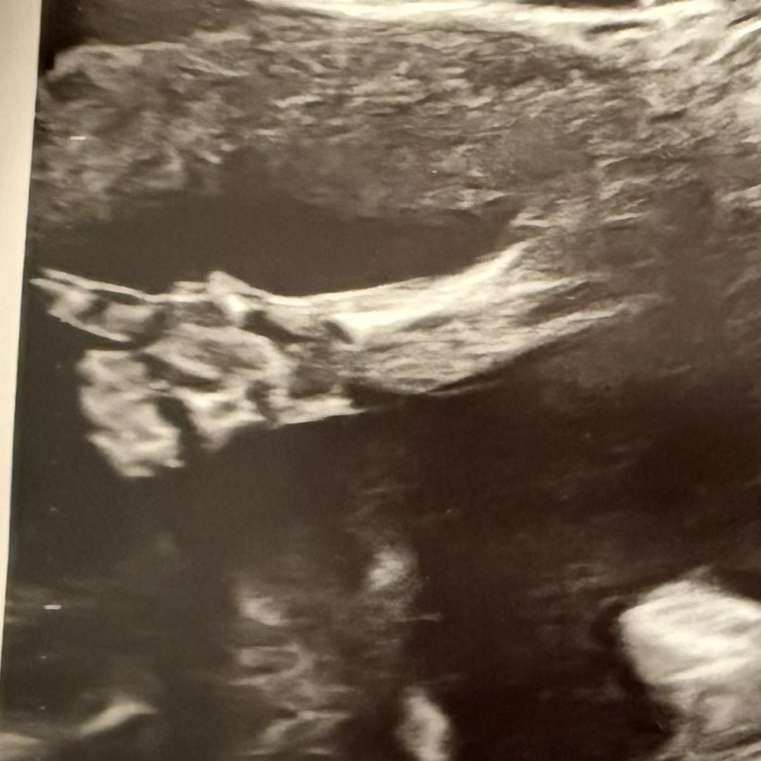 Photo shared by Victoria for their Babylist baby registry.