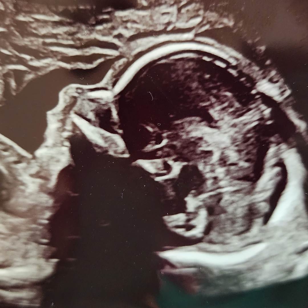 Photo shared by Audrey for their Babylist baby registry.