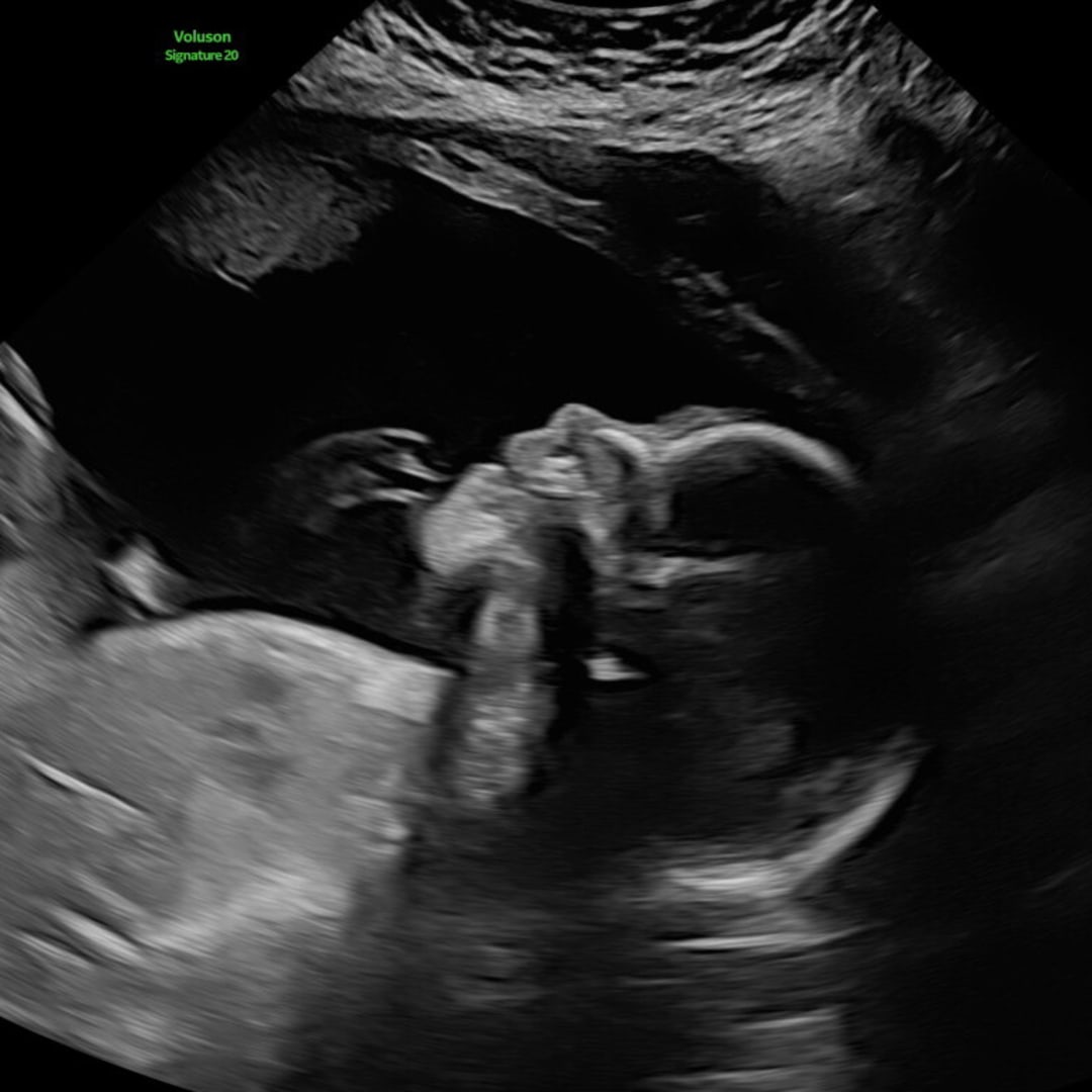 Photo shared by Morgan for their Babylist baby registry.