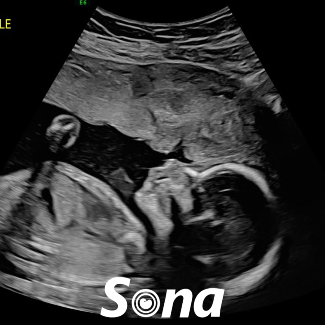 Photo shared by Jenna for their Babylist baby registry.