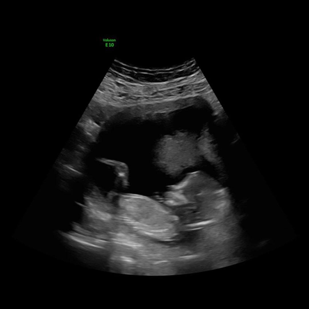 Photo shared by Katie for their Babylist baby registry.