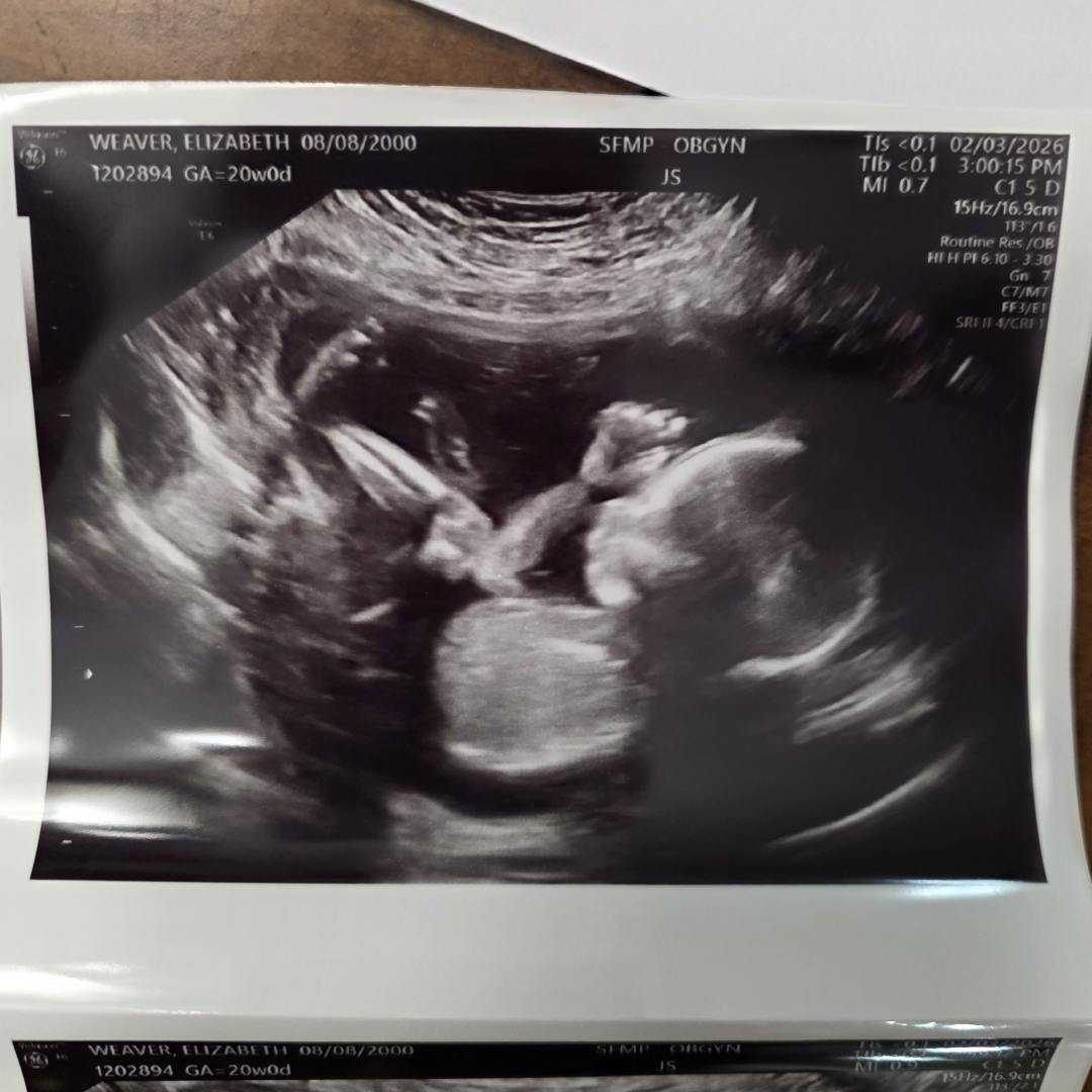 Photo shared by Elizabeth for their Babylist baby registry.