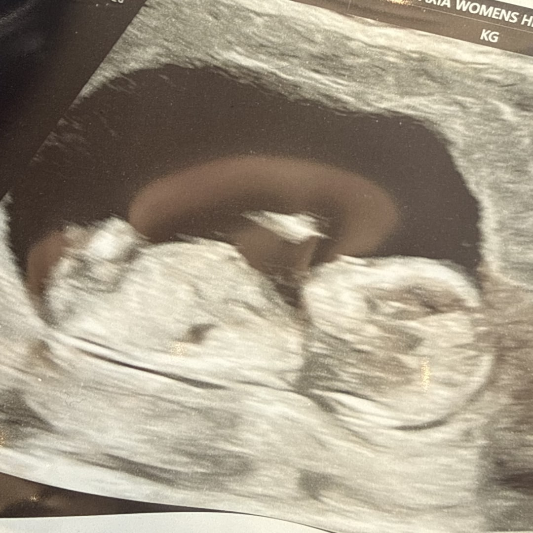 Photo shared by Gaby for their Babylist baby registry.