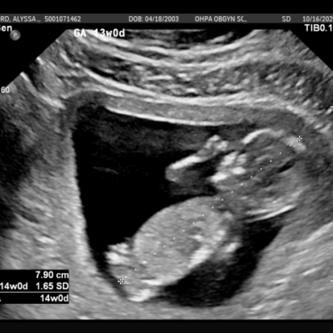 Photo shared by Alyssa for their Babylist baby registry.