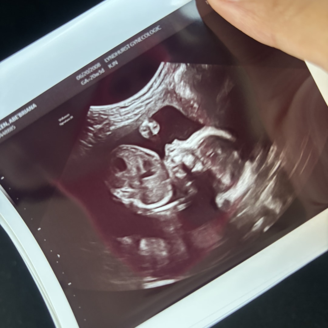 Photo shared by Abe’Briana for their Babylist baby registry.