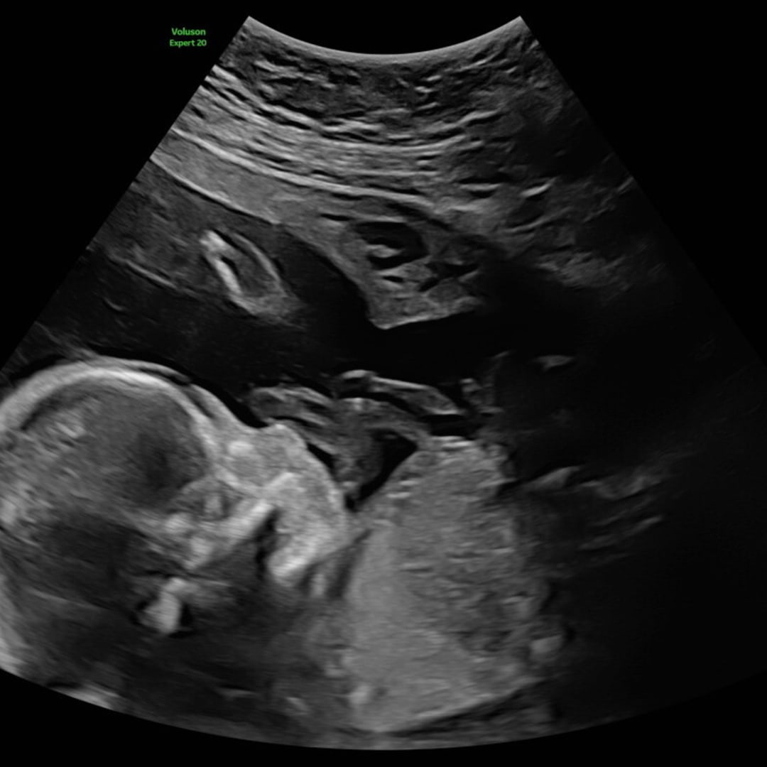 Photo shared by Whitney for their Babylist baby registry.