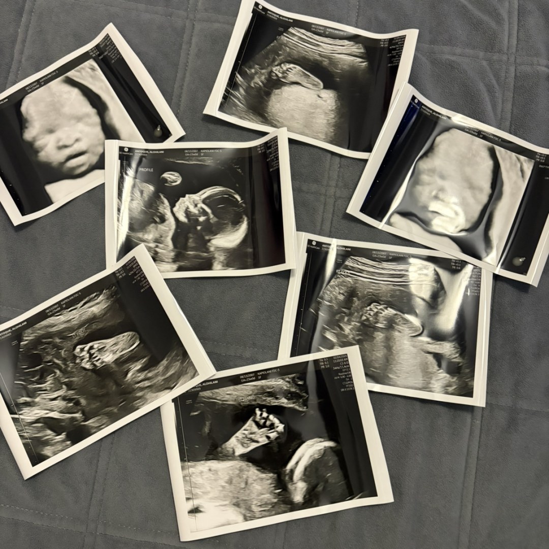 Photo shared by Alohilani for their Babylist baby registry.