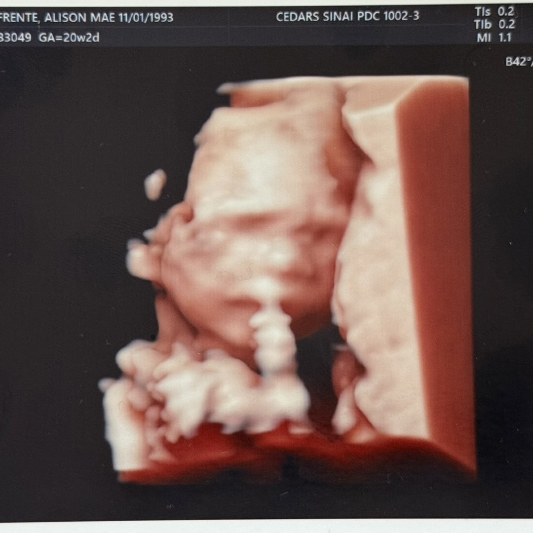 Photo shared by Alison for their Babylist baby registry.