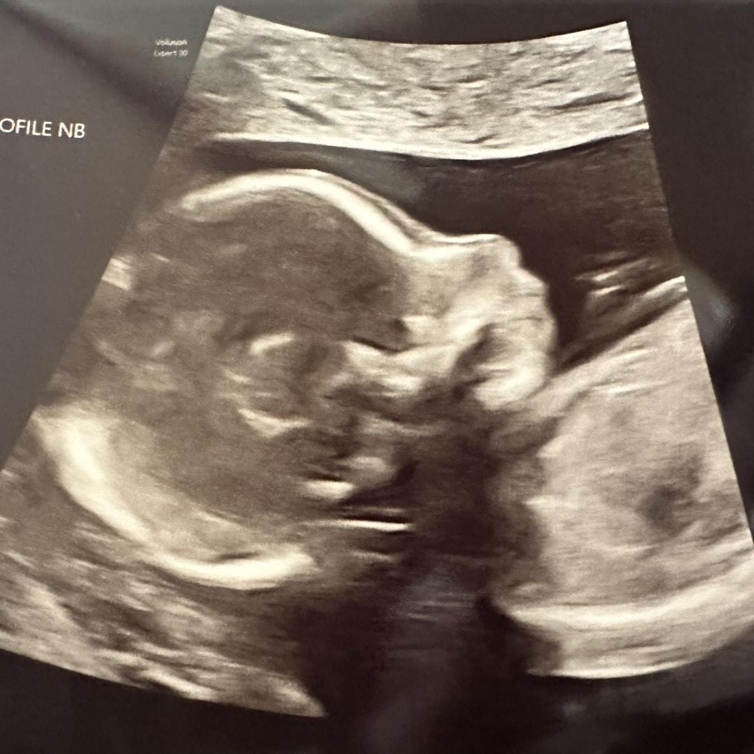 Photo shared by Alisha for their Babylist baby registry.