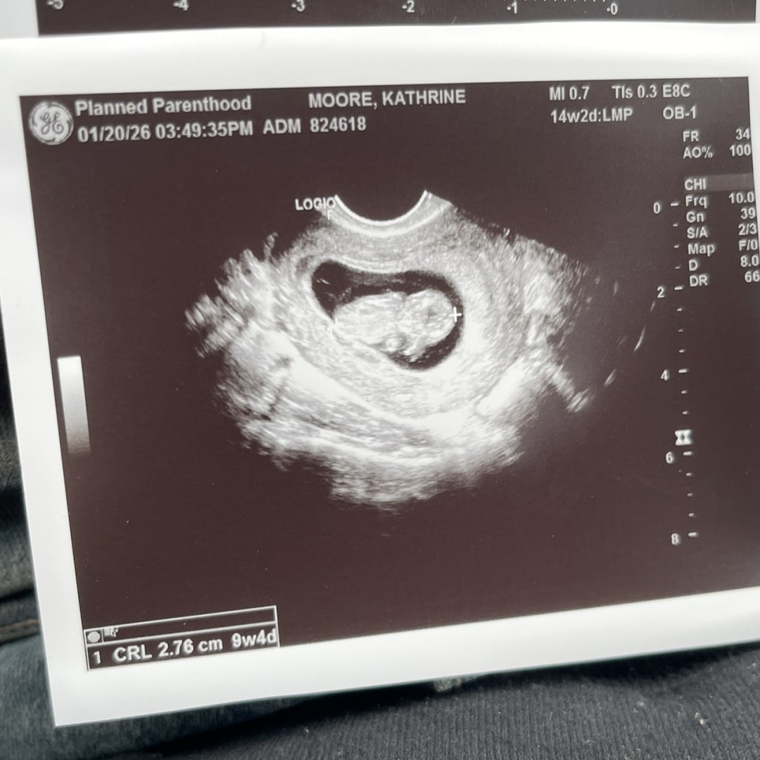 Photo shared by Katherine for their Babylist baby registry.