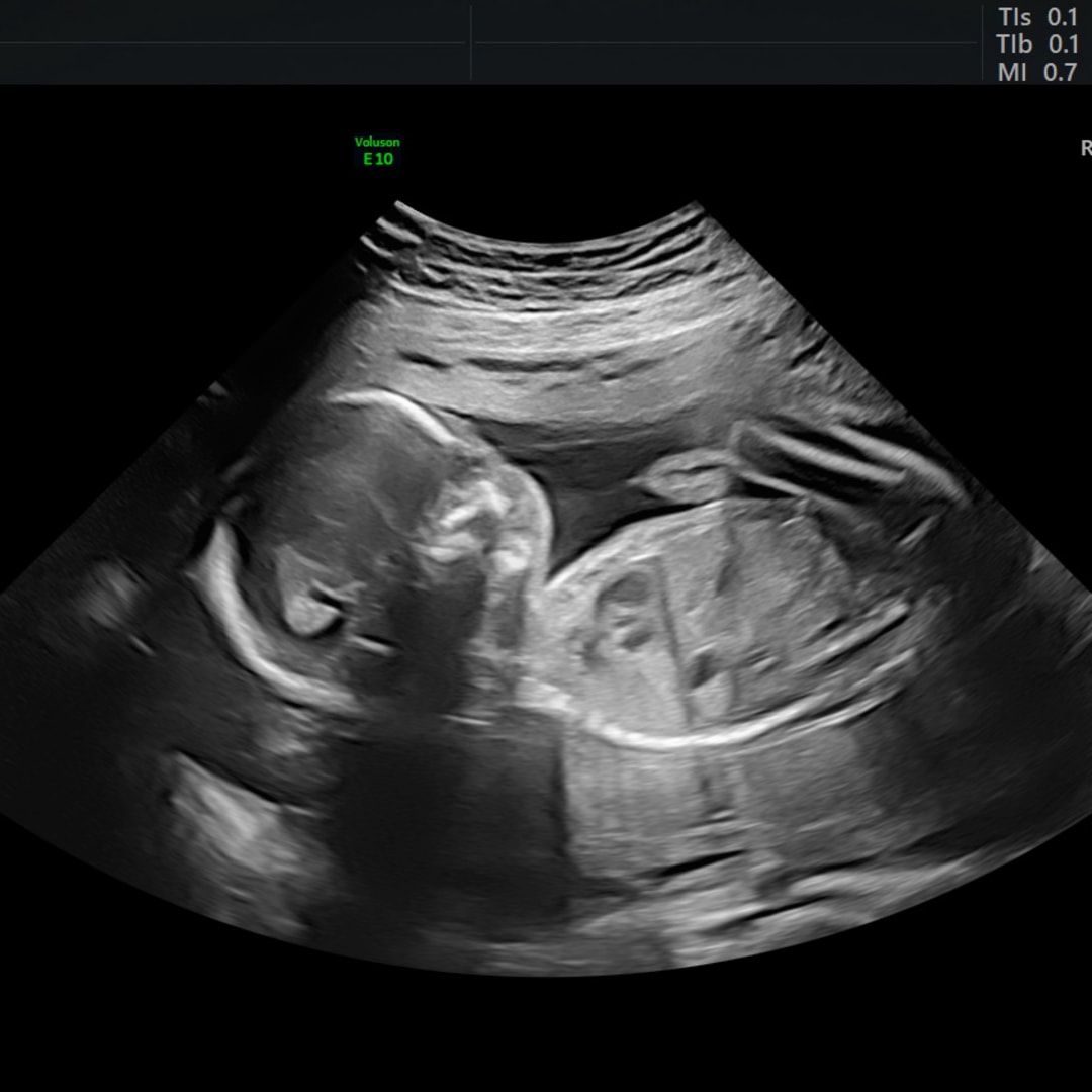 Photo shared by Nicole for their Babylist baby registry.