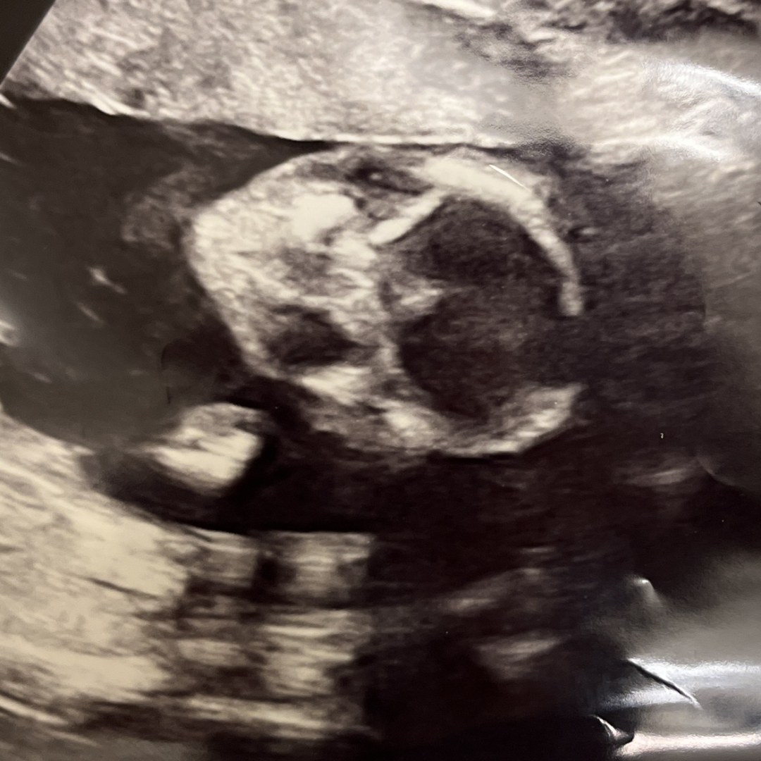 Photo shared by Sophia for their Babylist baby registry.