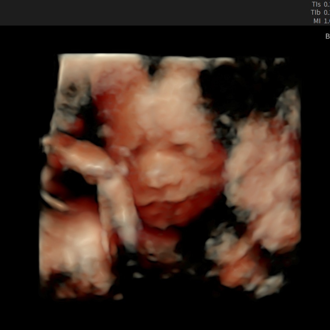 Photo shared by Reilly for their Babylist baby registry.