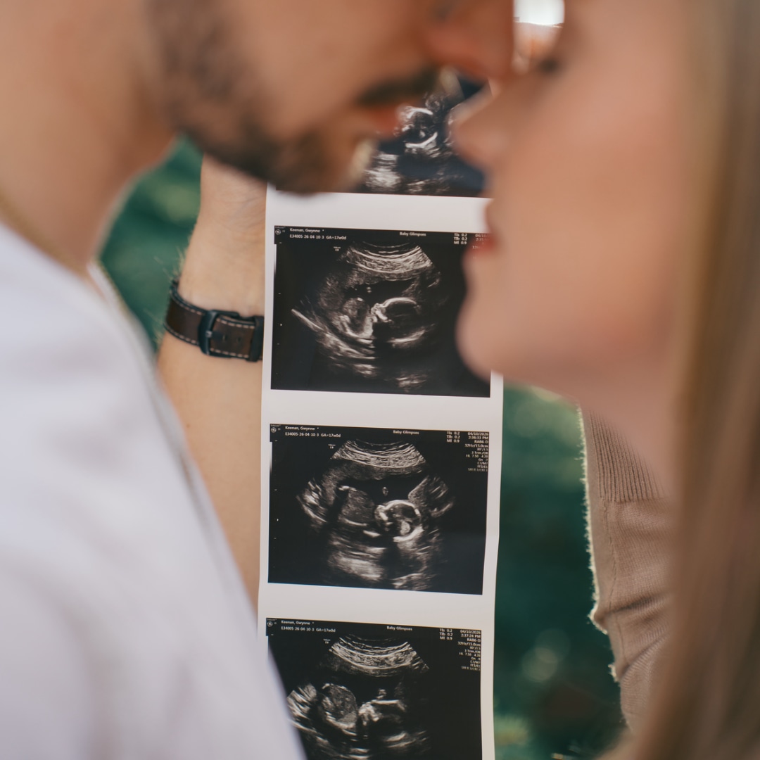 Photo shared by Gwynne for their Babylist baby registry.