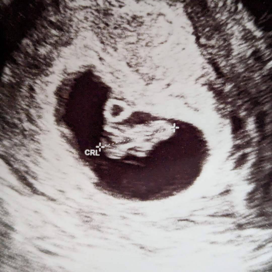 Photo shared by Shannon for their Babylist baby registry.