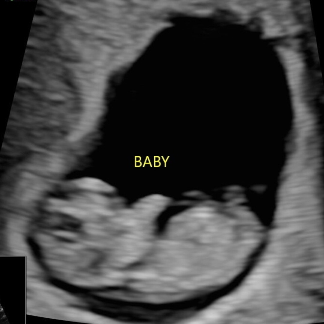 Photo shared by Rockell for their Babylist baby registry.