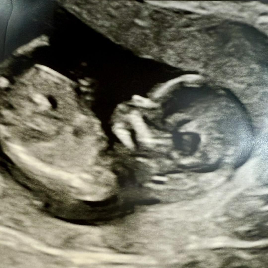 Photo shared by Binita for their Babylist baby registry.
