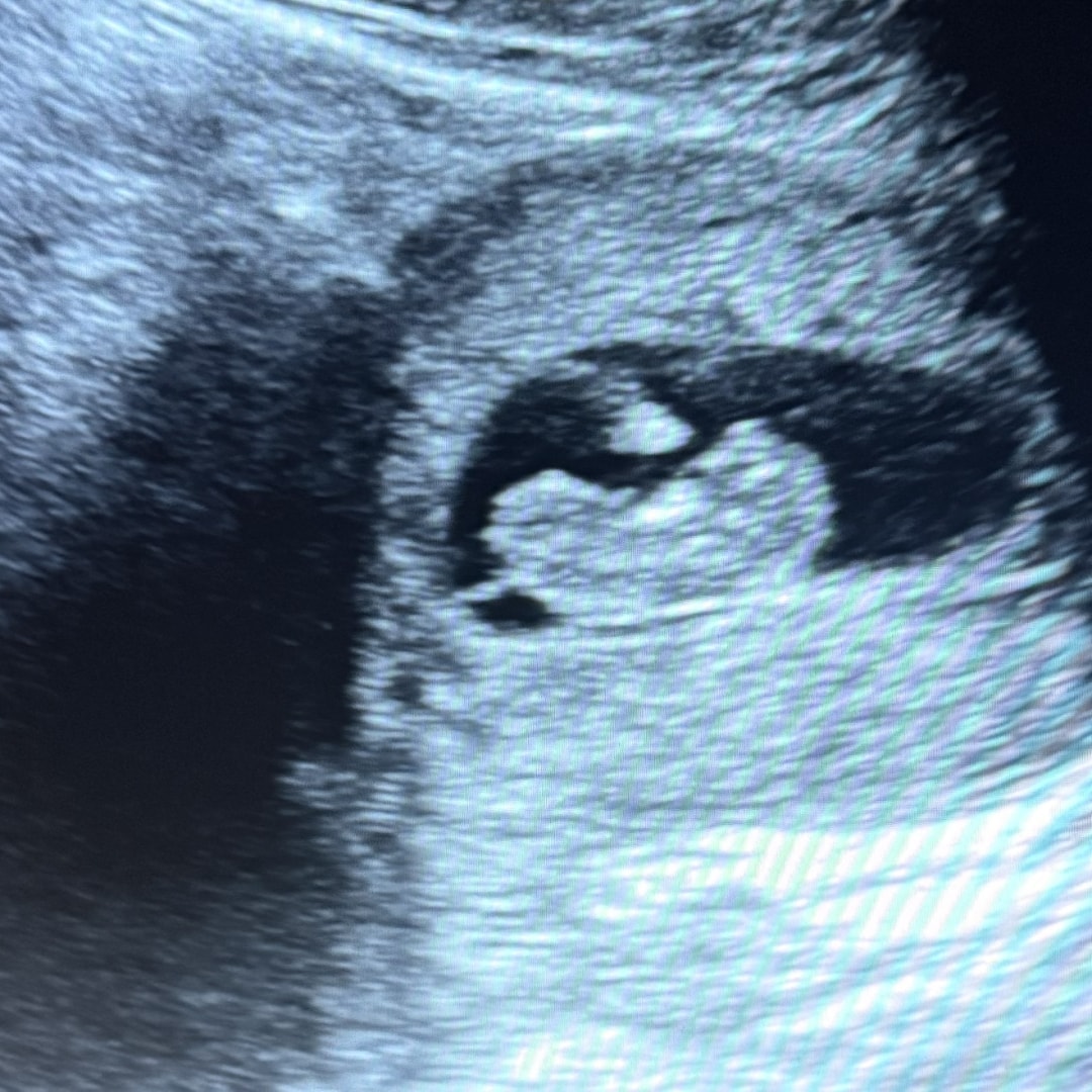 Photo shared by Haley for their Babylist baby registry.