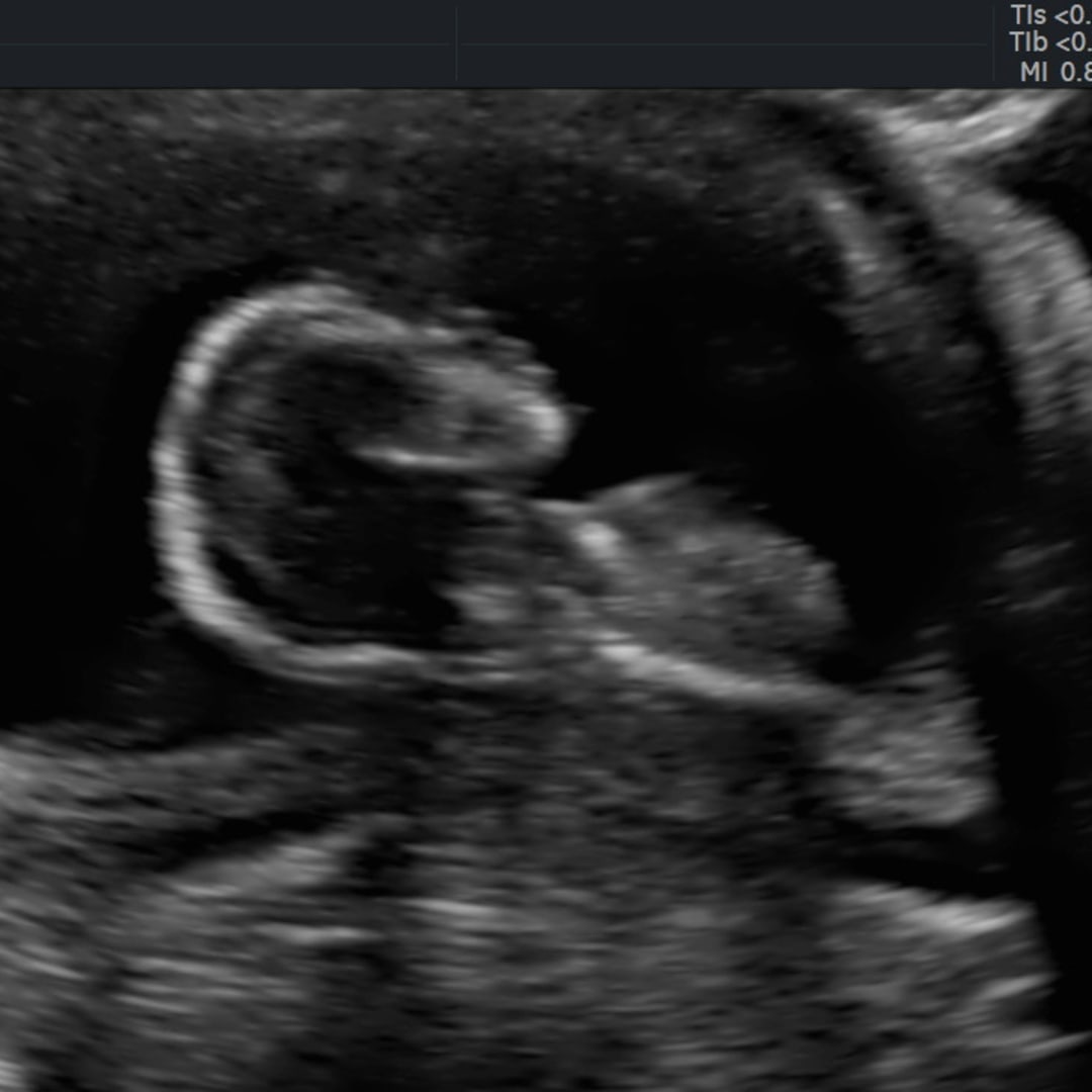 Photo shared by Allison for their Babylist baby registry.
