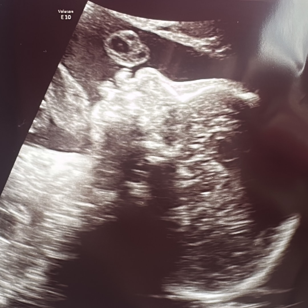 Photo shared by Sabrina for their Babylist baby registry.