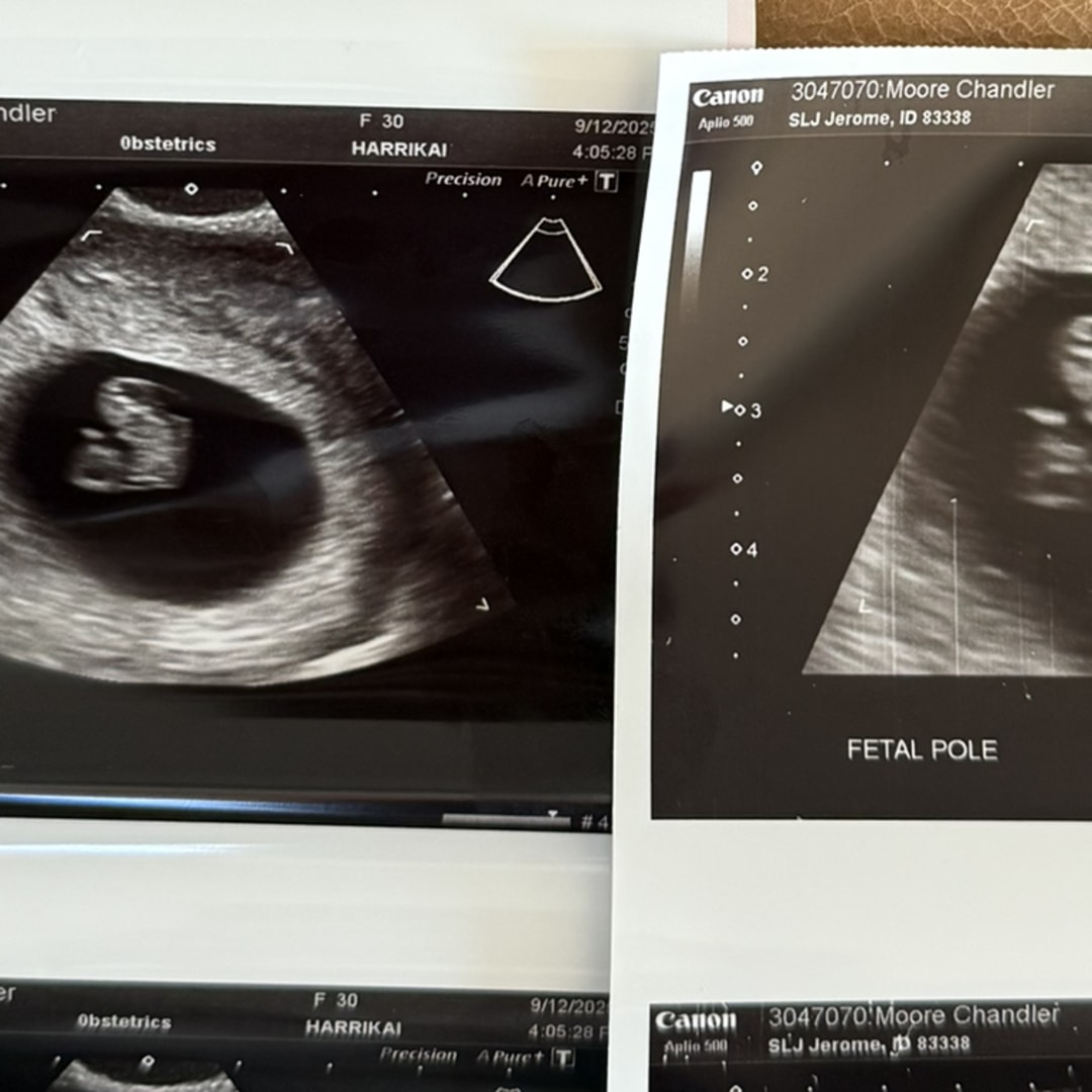 Photo shared by Chandler for their Babylist baby registry.