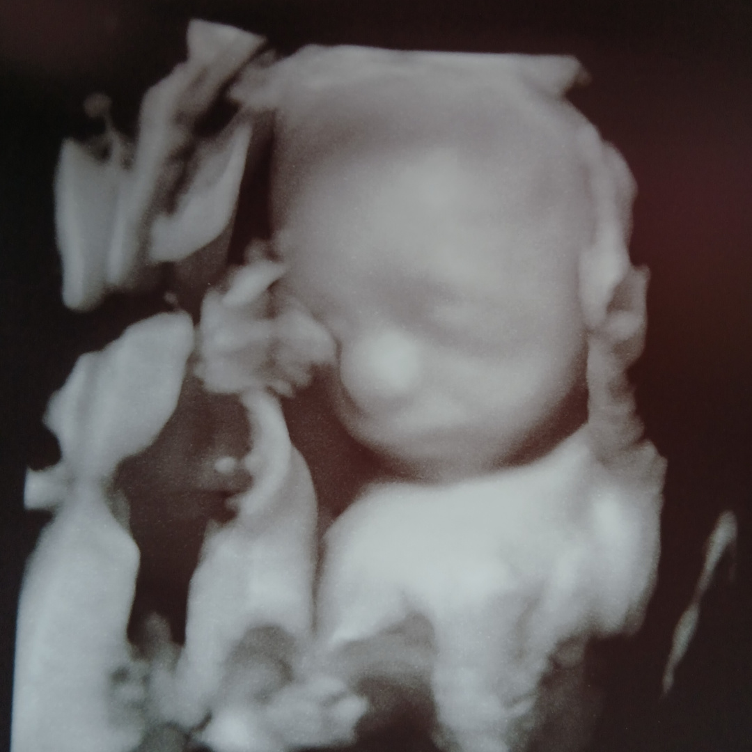 Photo shared by Audra for their Babylist baby registry.