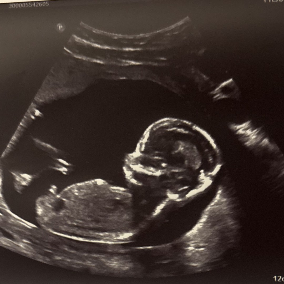 Photo shared by Abby for their Babylist baby registry.