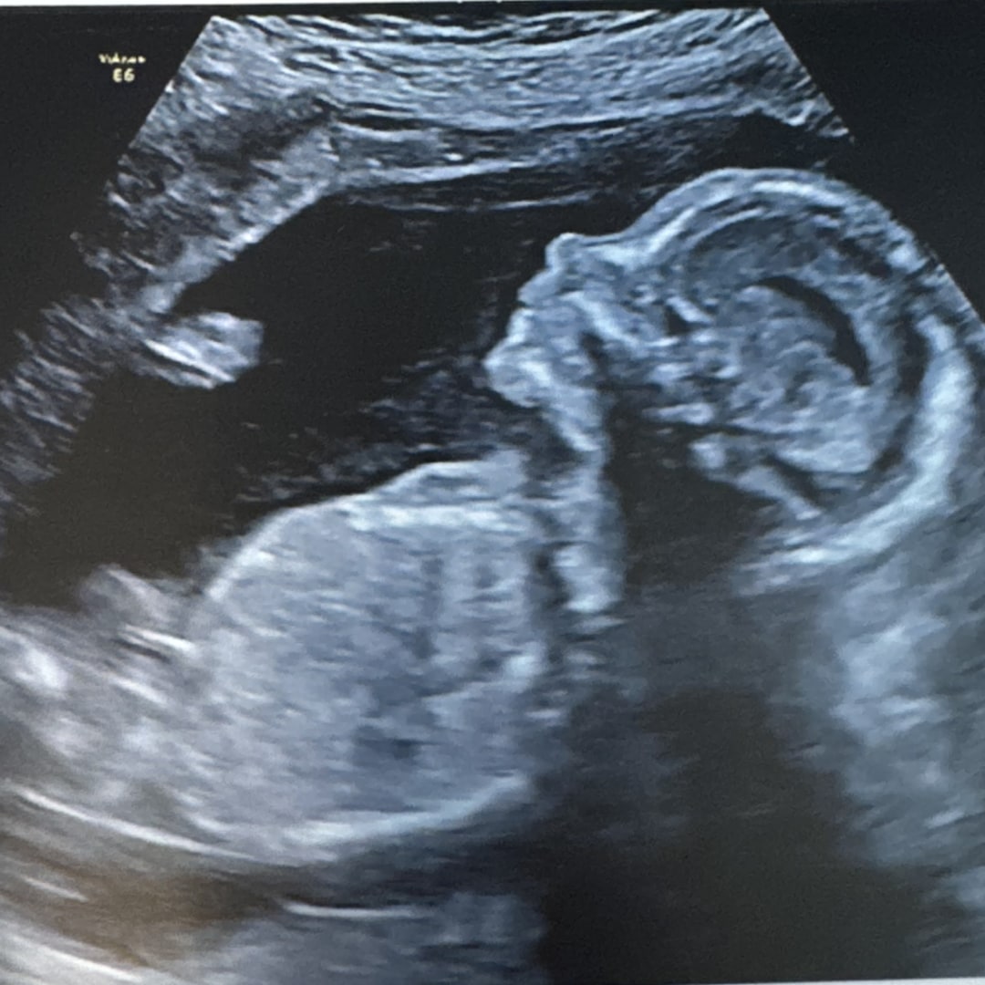 Photo shared by Alyssa for their Babylist baby registry.