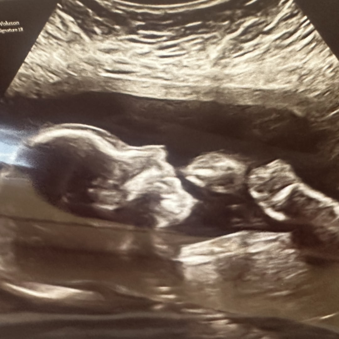 Photo shared by Alexandra for their Babylist baby registry.