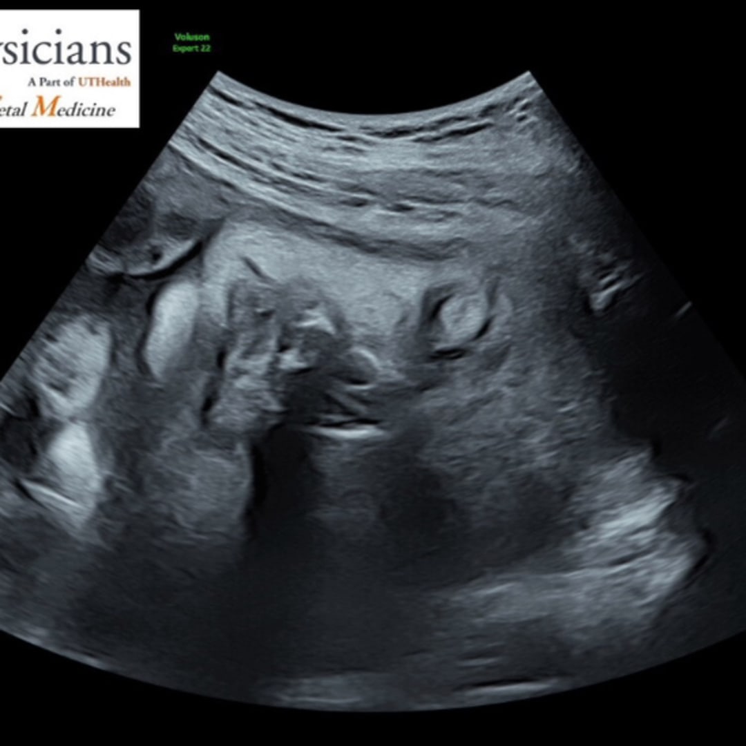 Photo shared by Nikk for their Babylist baby registry.