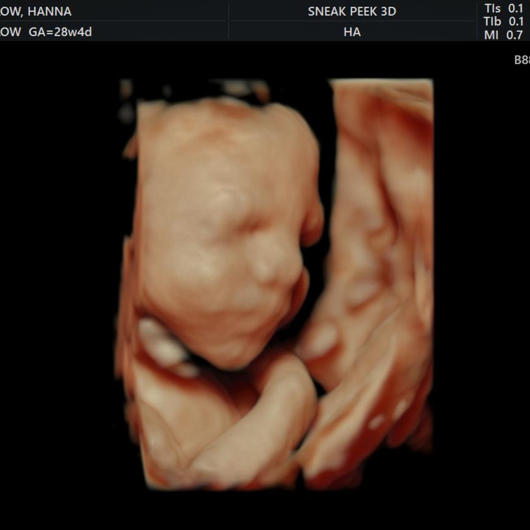 Photo shared by Hanna for their Babylist baby registry.