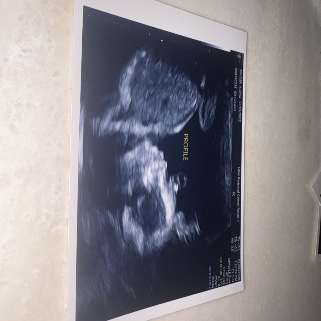 Photo shared by Alexia for their Babylist baby registry.