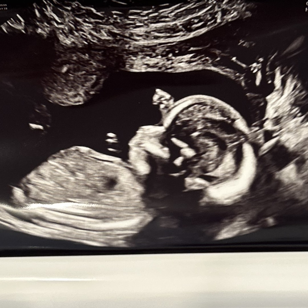 Photo shared by Aimee for their Babylist baby registry.