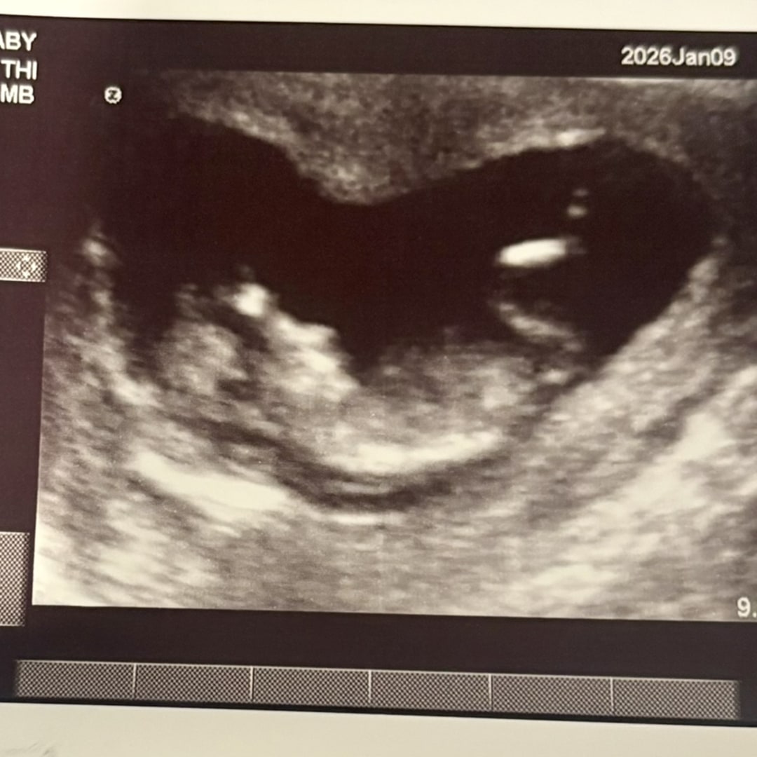 Photo shared by McKenzie for their Babylist baby registry.