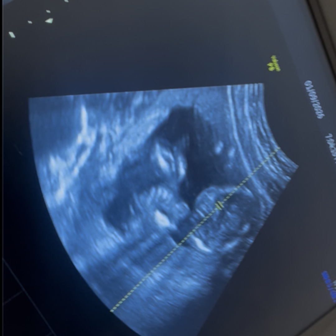 Photo shared by Marissa for their Babylist baby registry.